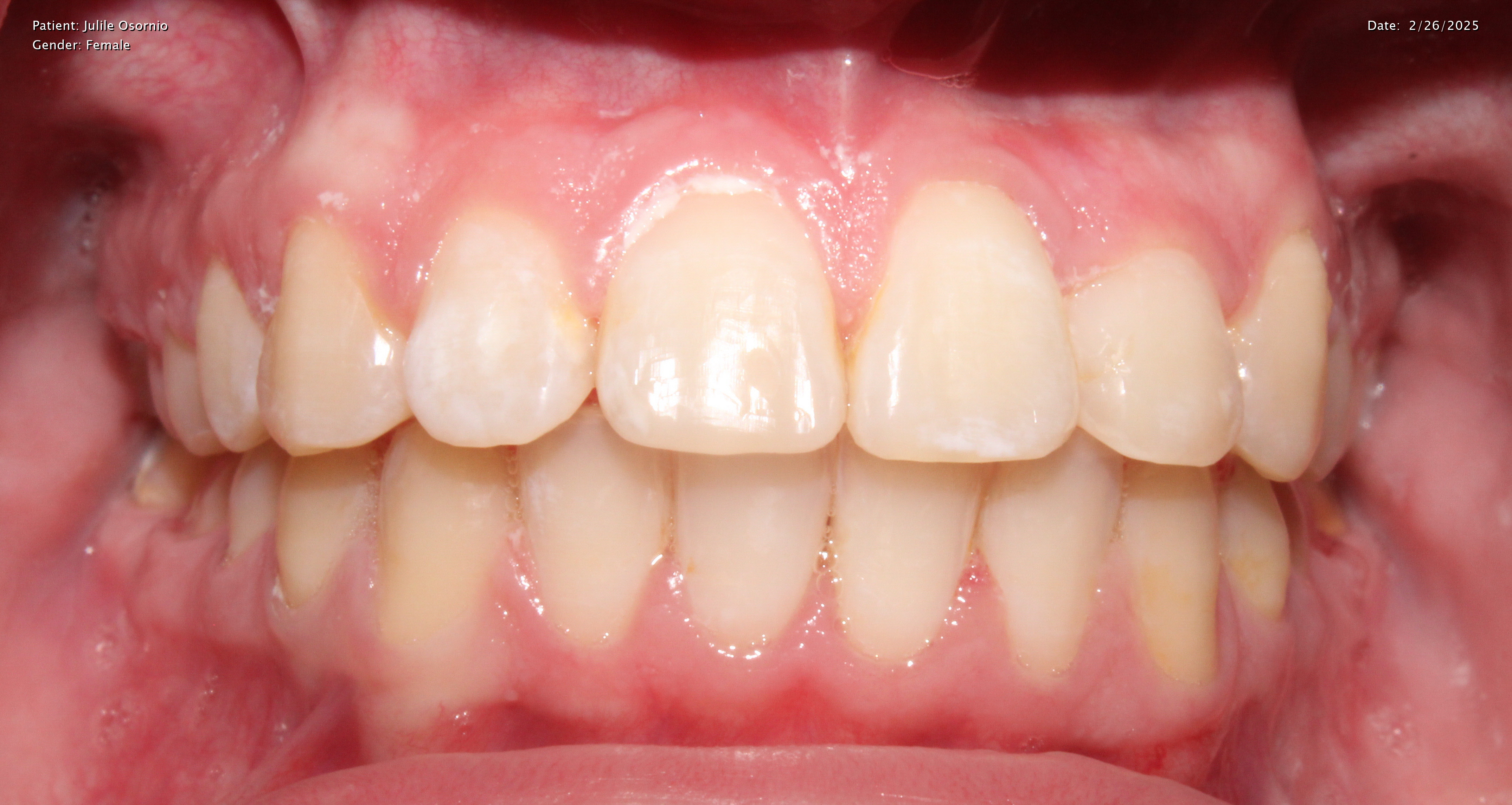 Upwards Orthodontics