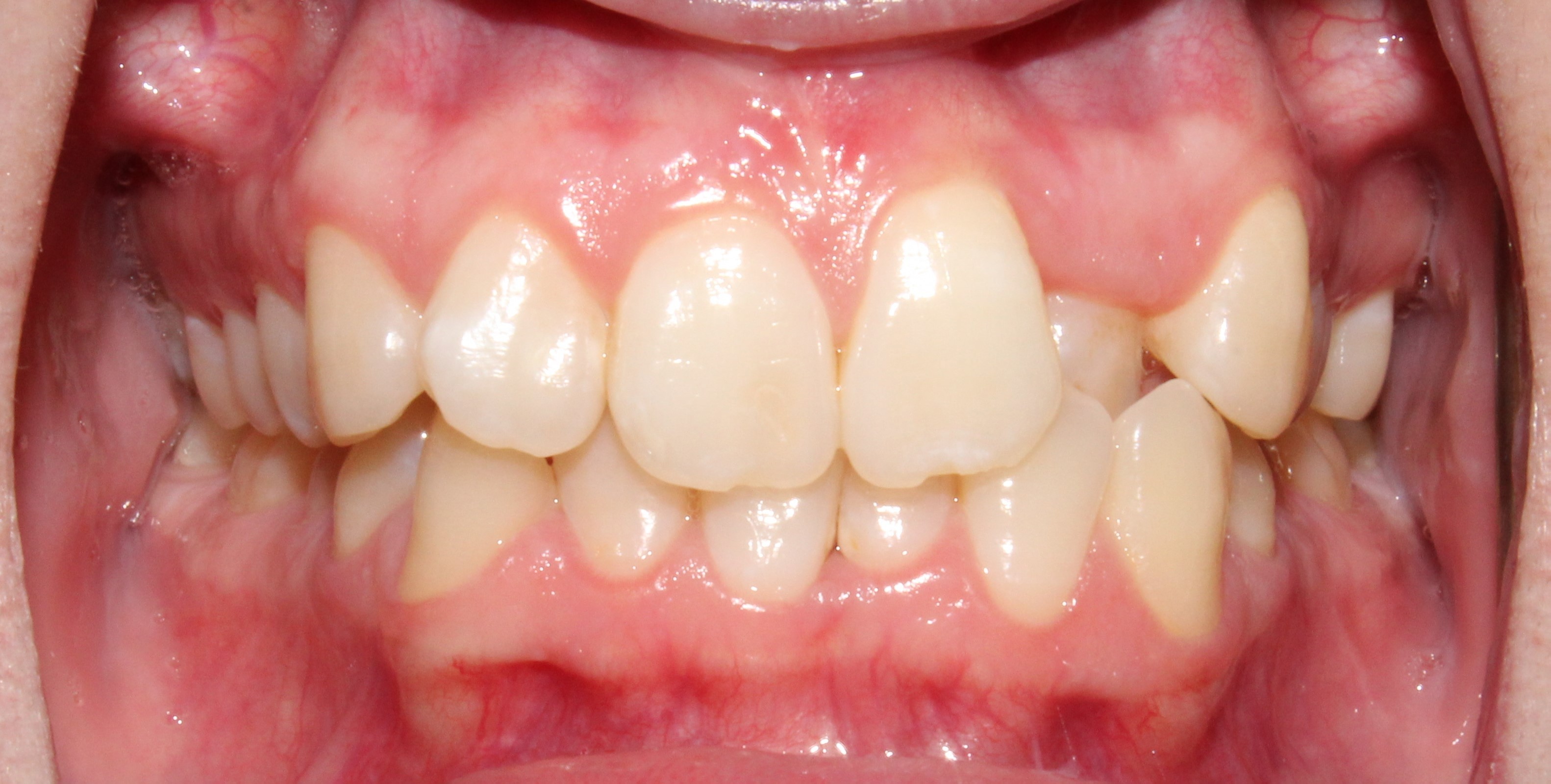 Upwards Orthodontics